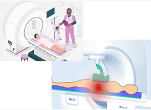 超音波温度測定技術(非侵襲温度測定システム)