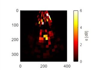 超音波温度測定技術(非侵襲温度測定システム)